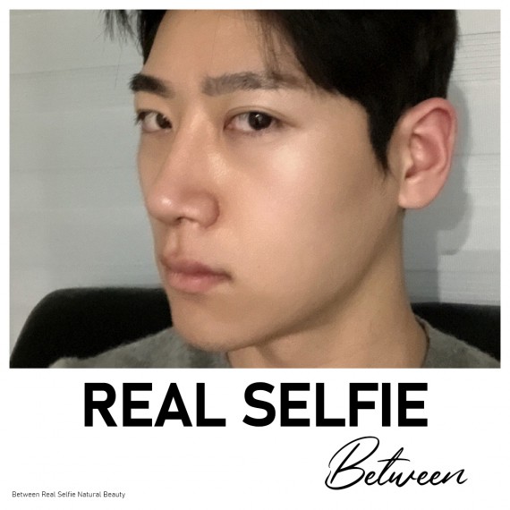 비…